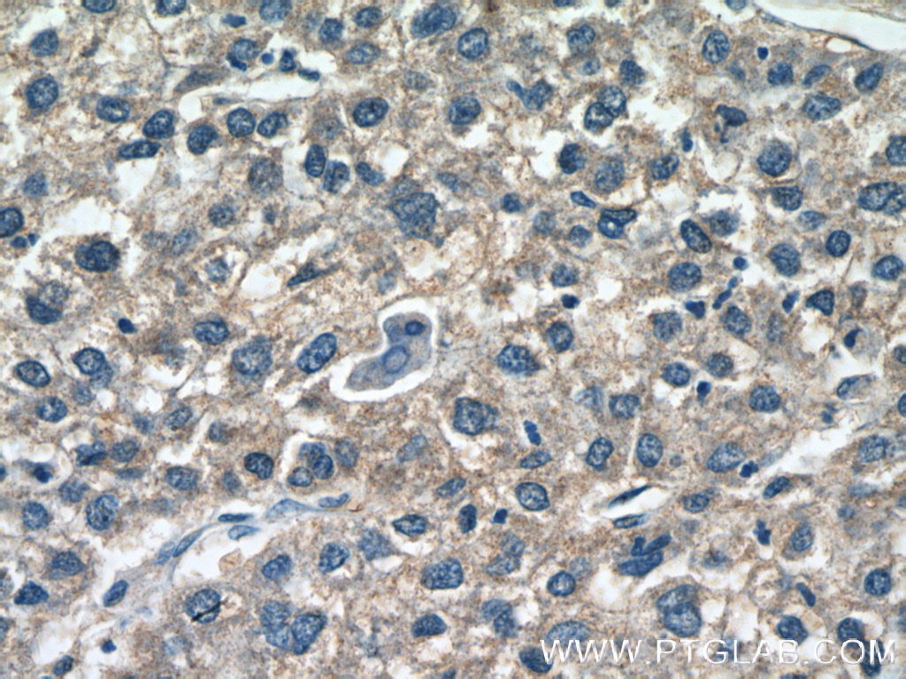 AADAC Polyclonal antibody
