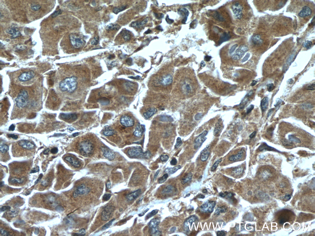 ELAC1 Polyclonal antibody
