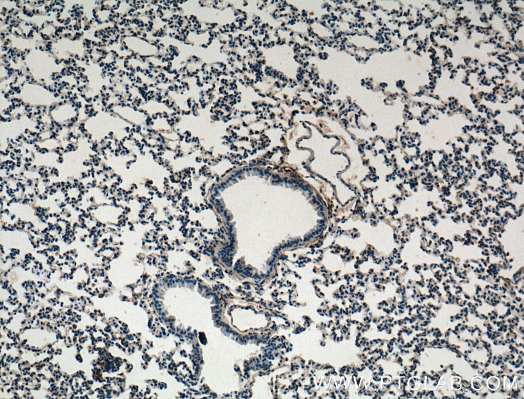TIMP2 Polyclonal antibody