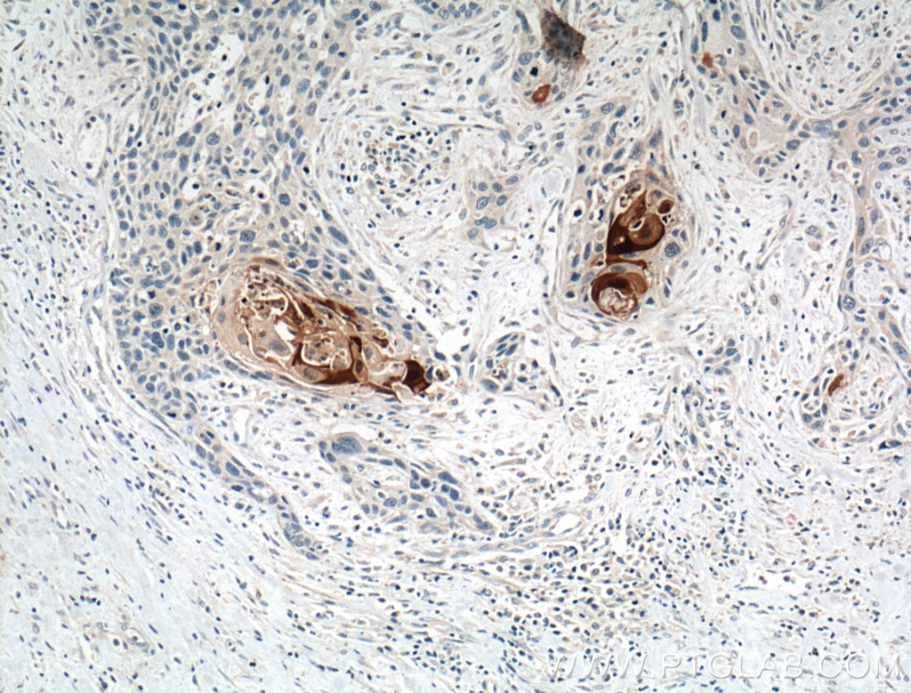 S100A7/Psoriasin Polyclonal antibody