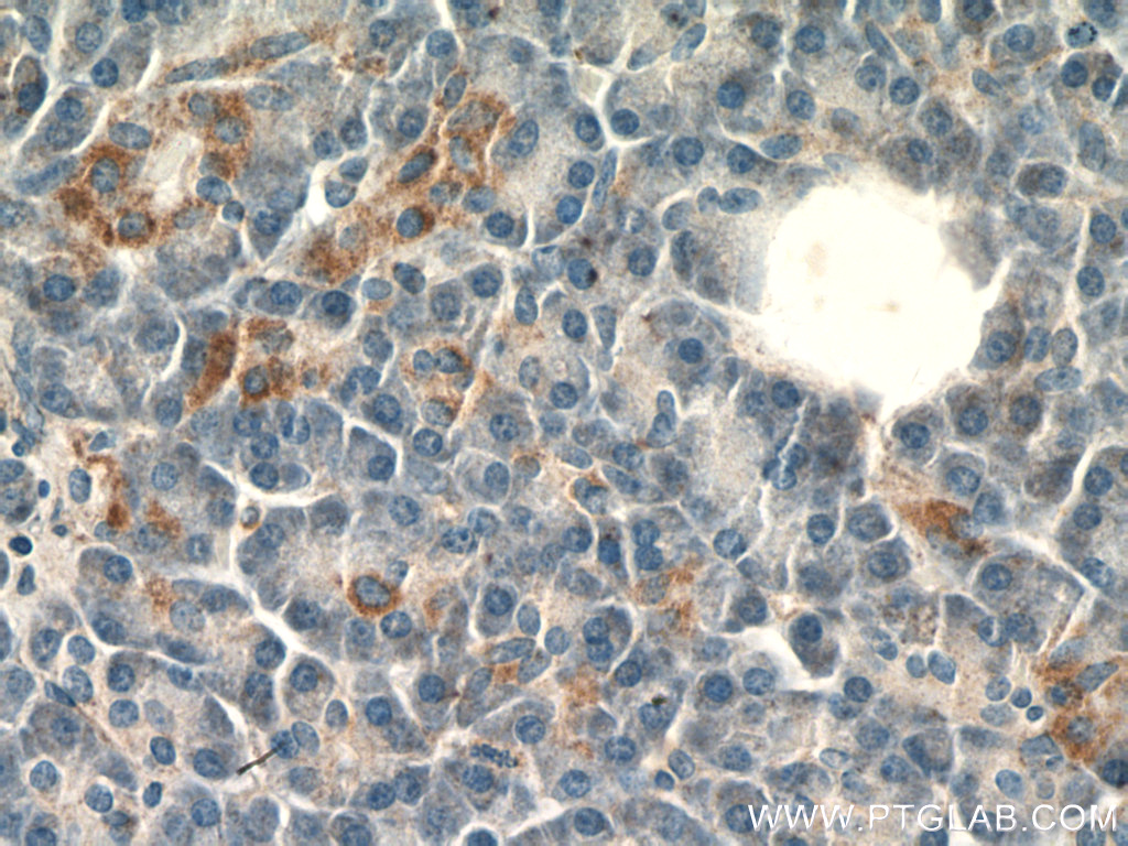SLC25A29 Polyclonal antibody