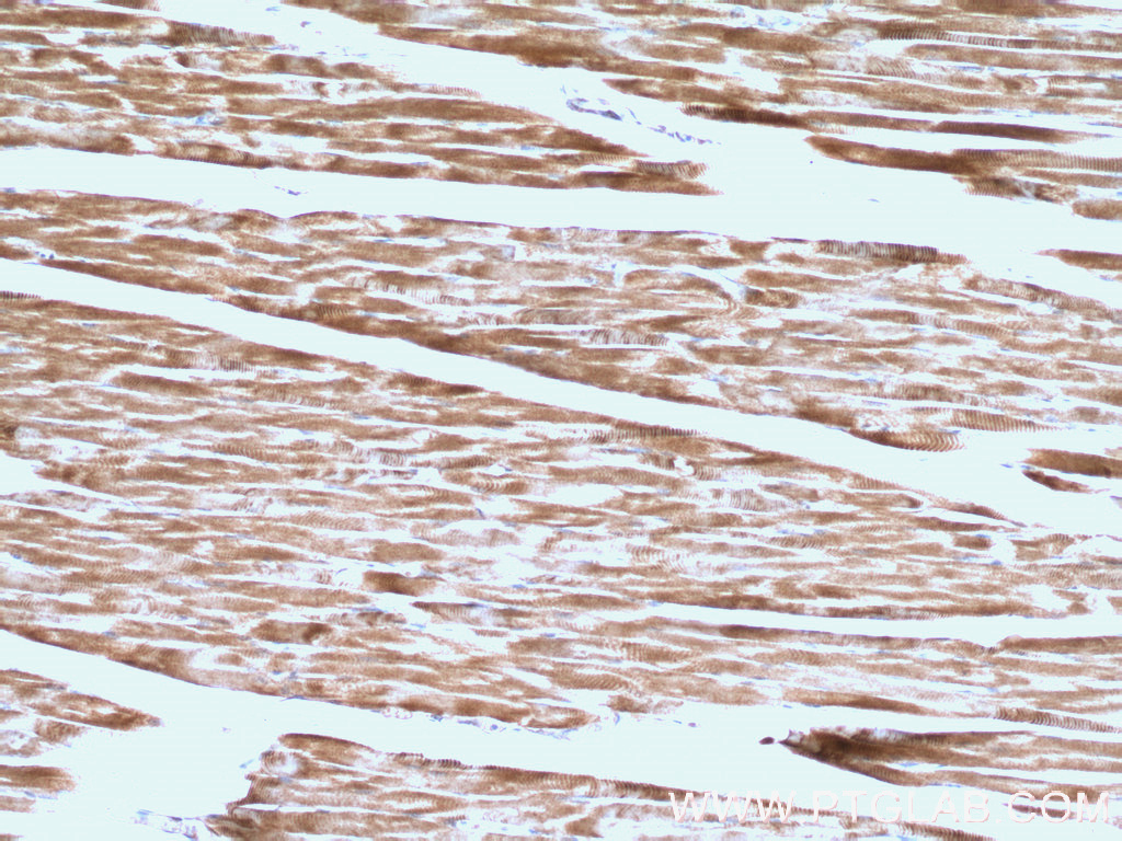 Calsequestrin 1 Polyclonal antibody