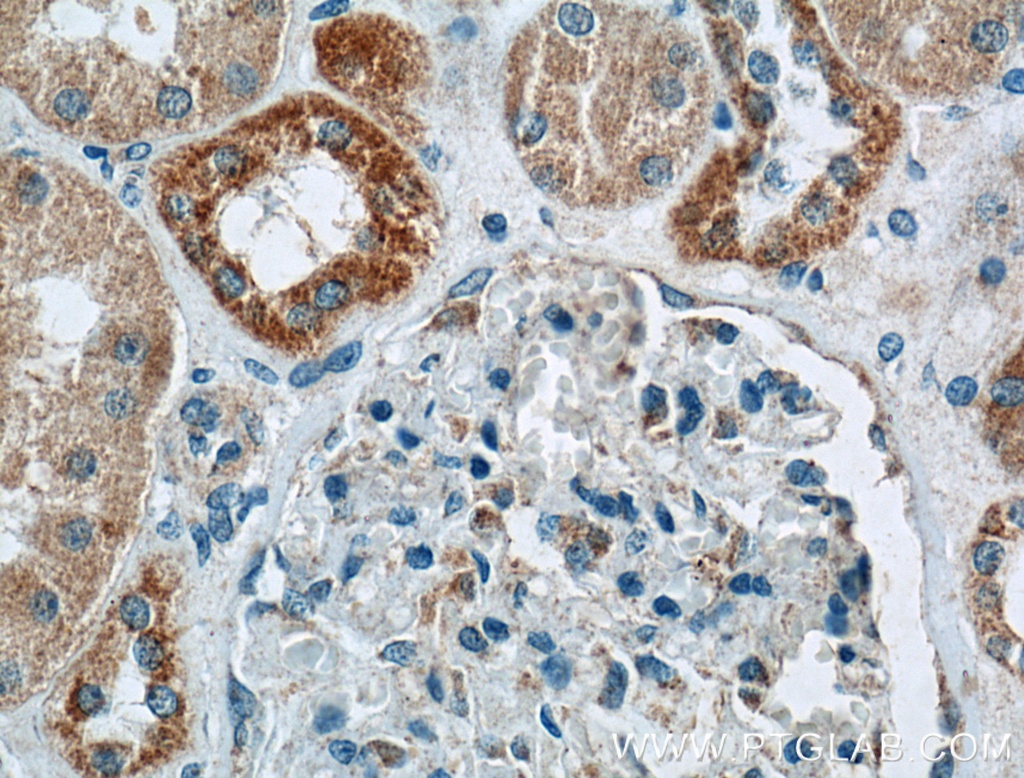 BDKRB1 Polyclonal antibody