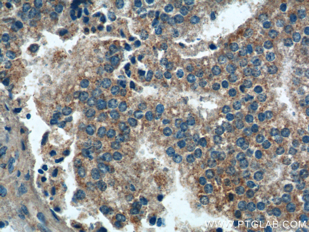 PARL Polyclonal antibody