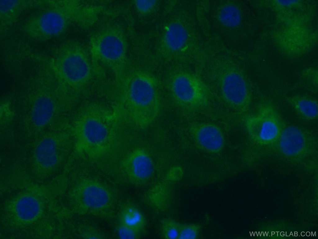 CYR61/CCN1 Polyclonal antibody