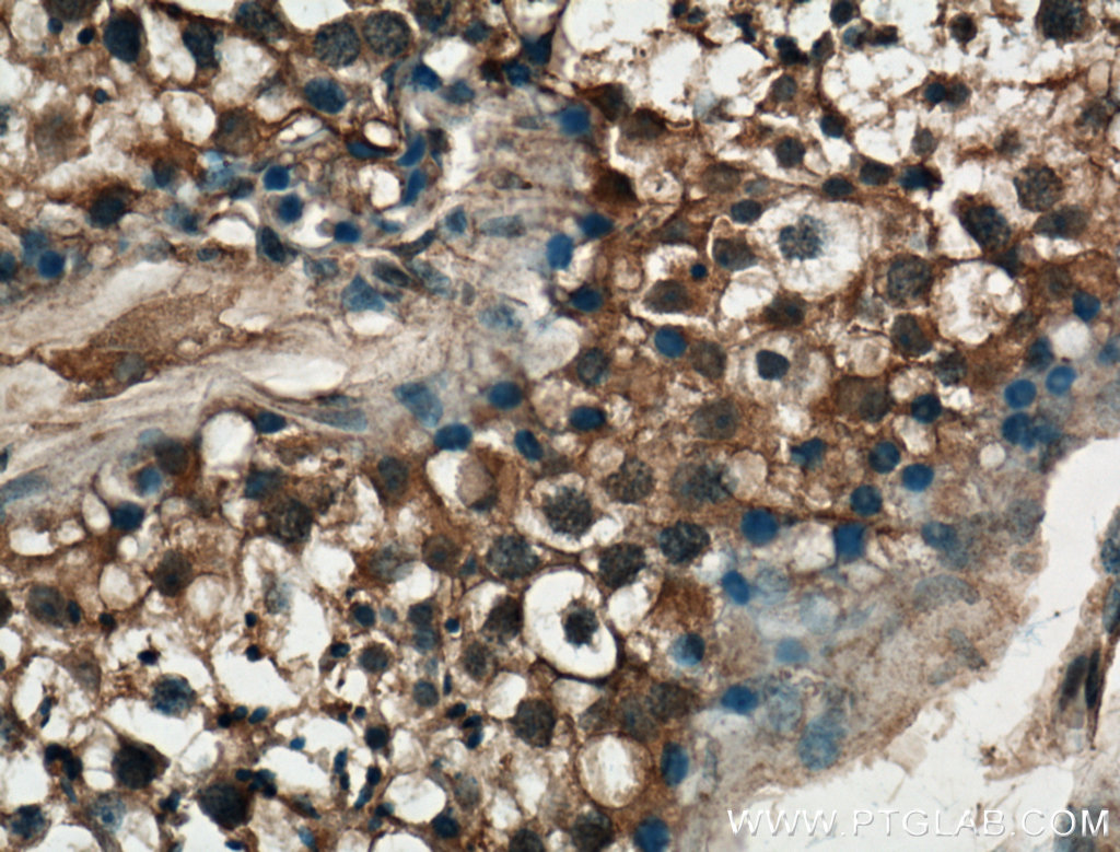 P3H1 Polyclonal antibody