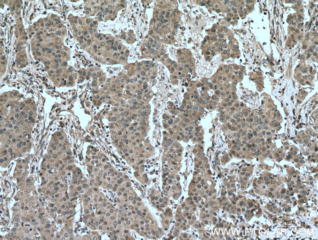 DUSP9 Polyclonal antibody