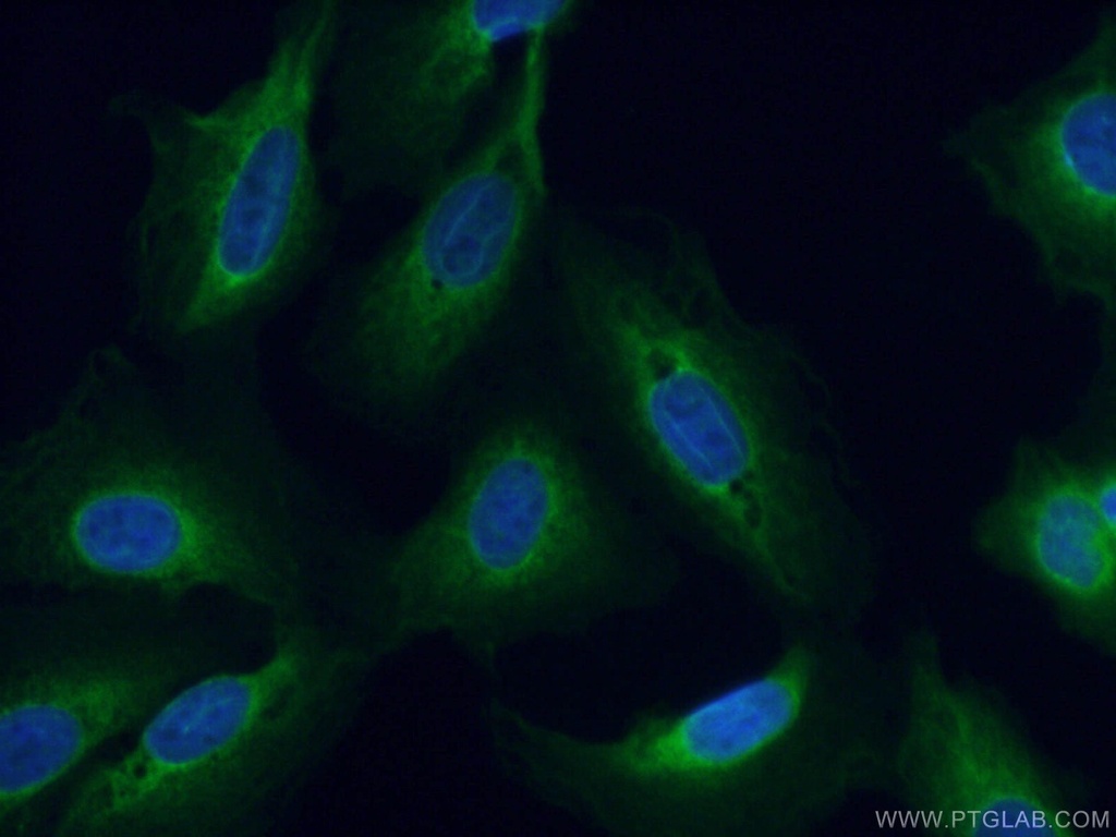 DNAJC3 Polyclonal antibody