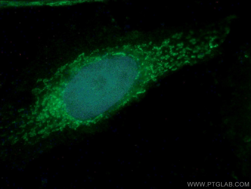 ATP8 Polyclonal antibody