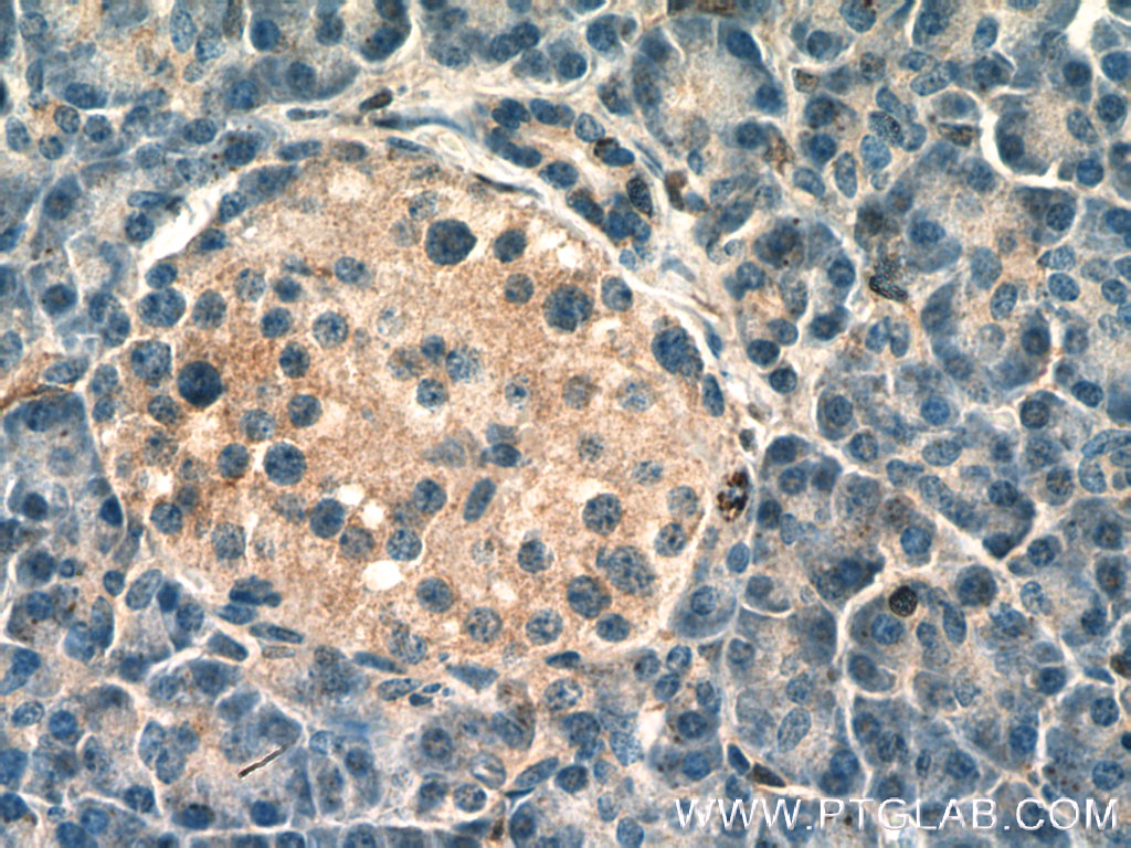 FAM176A Polyclonal antibody