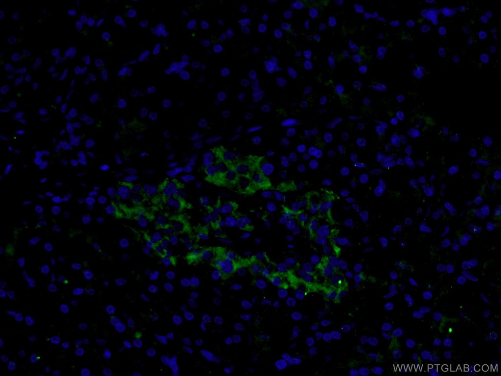 SLC17A9 Polyclonal antibody