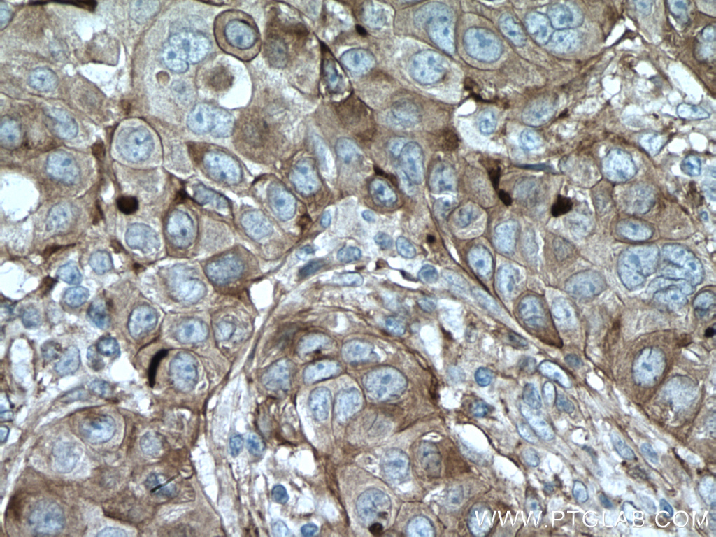 CYBRD1 Polyclonal antibody