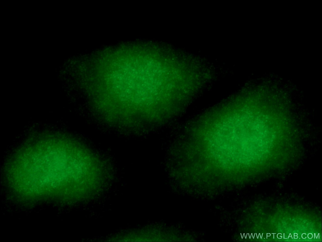 APTX Polyclonal antibody