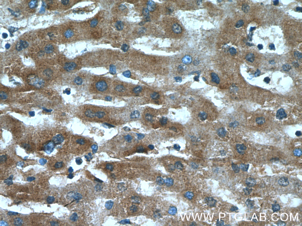 CXCR3 Polyclonal antibody