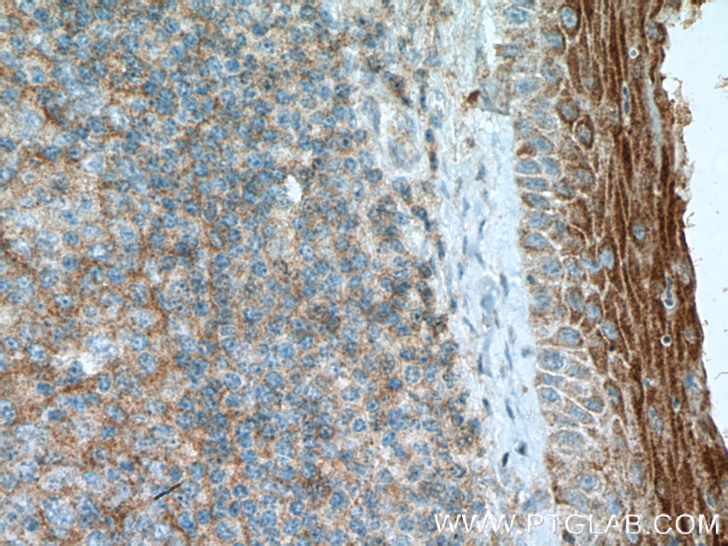 FCHO1 Polyclonal antibody