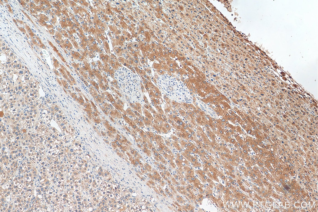 Plasminogen Polyclonal antibody