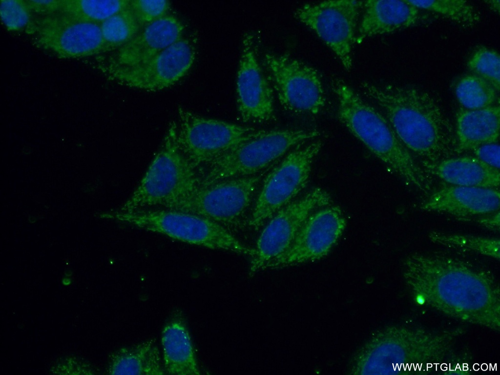 YTHDF2 Polyclonal antibody