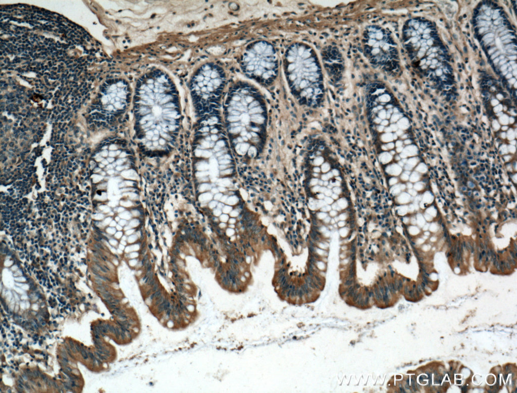 IL-24 Polyclonal antibody