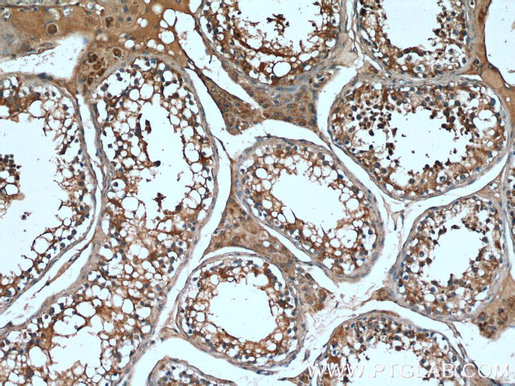 TMBIM6 Polyclonal antibody