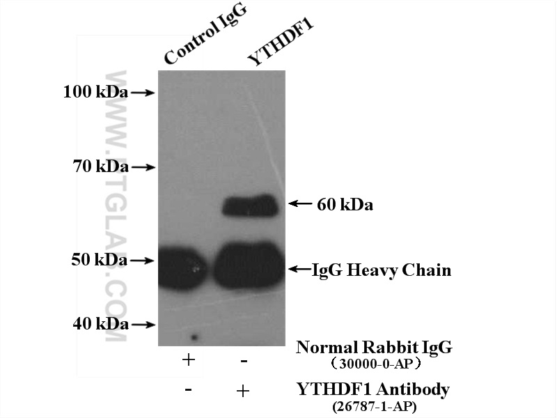 YTHDF1 Polyclonal antibody