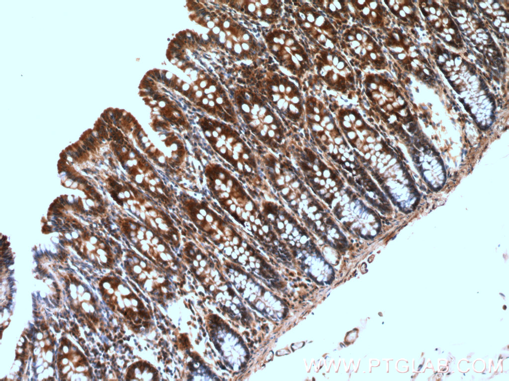 GRLF1 Polyclonal antibody