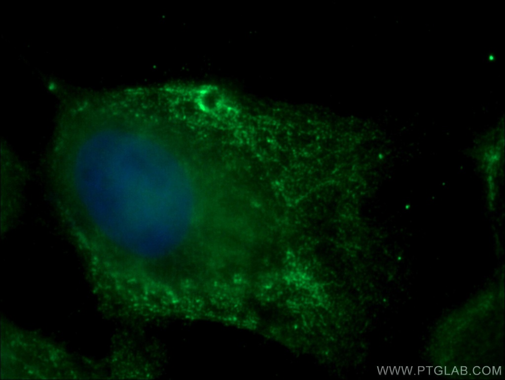 SIPA1 Polyclonal antibody