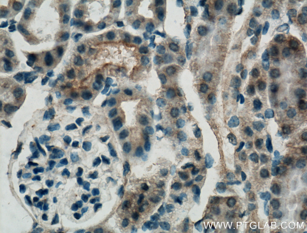 SLC22A7 Polyclonal antibody