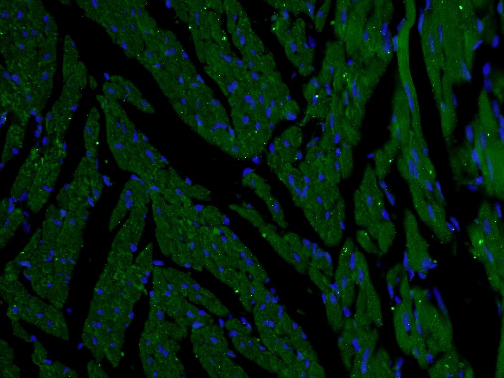 SLC25A12 Polyclonal antibody