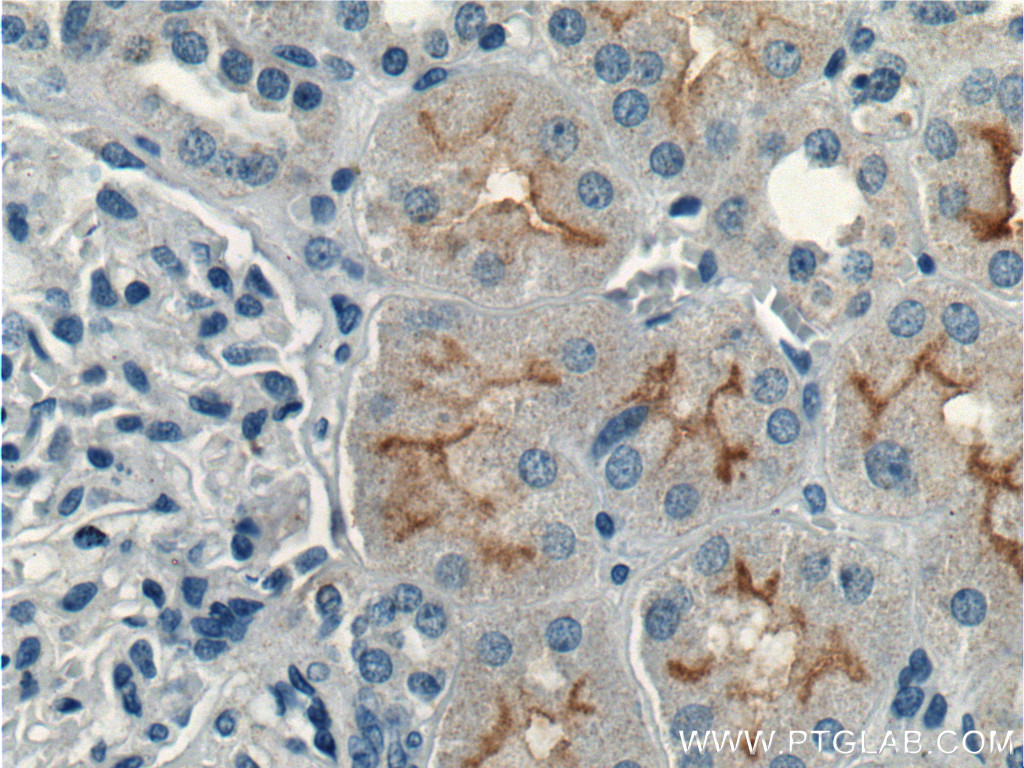 CLCN5 Polyclonal antibody