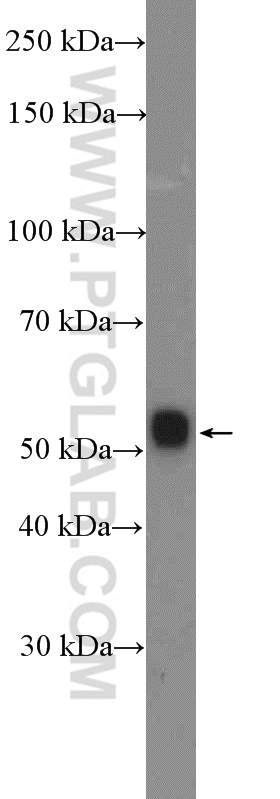 WDR41 Polyclonal antibody