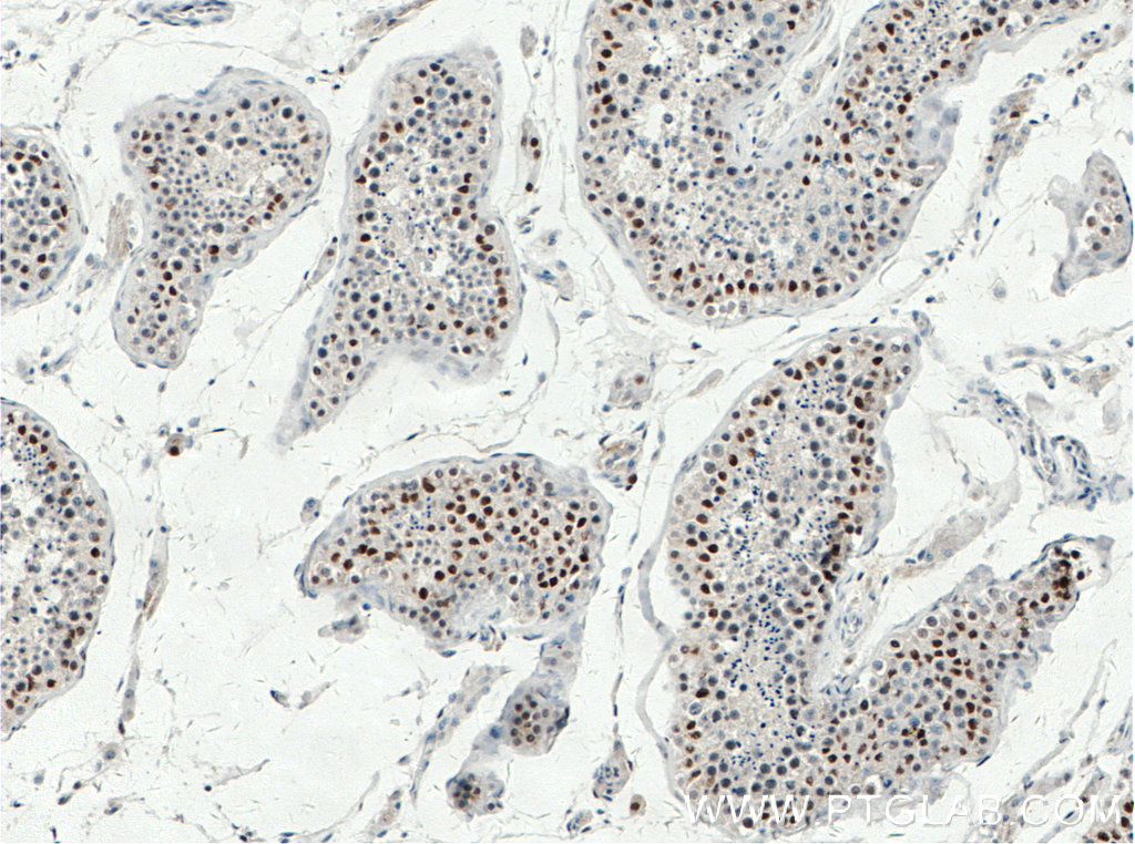 TP53RK Polyclonal antibody