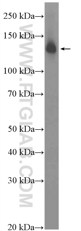 RFX1 Polyclonal antibody