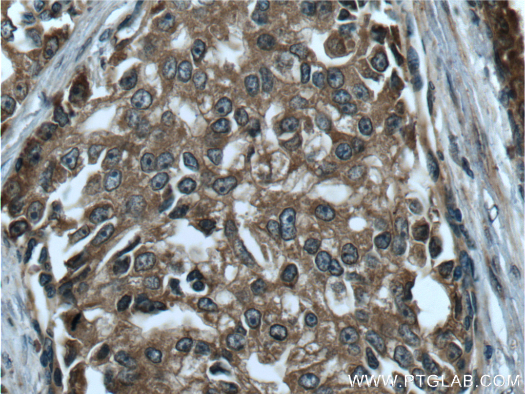 RAF1 Polyclonal antibody