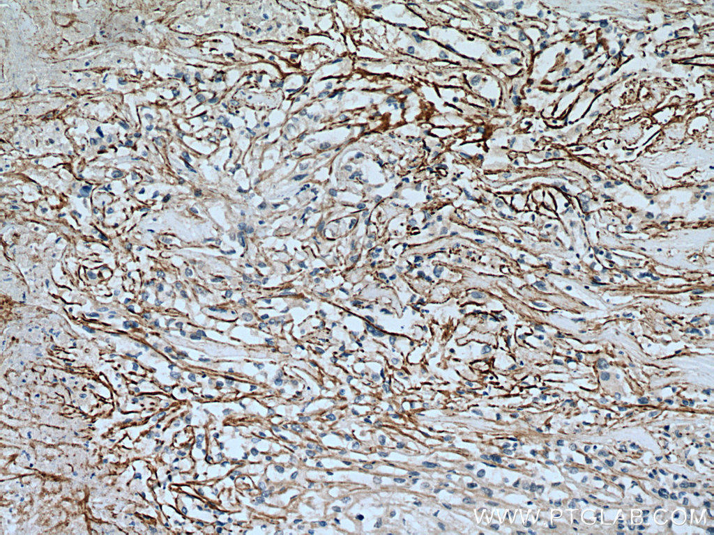 SLC7A11/xCT Polyclonal antibody