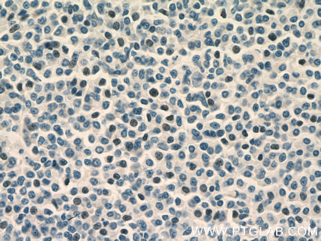TLX1 Polyclonal antibody
