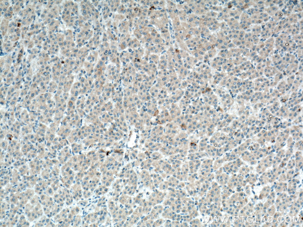 HGF Alpha Polyclonal antibody