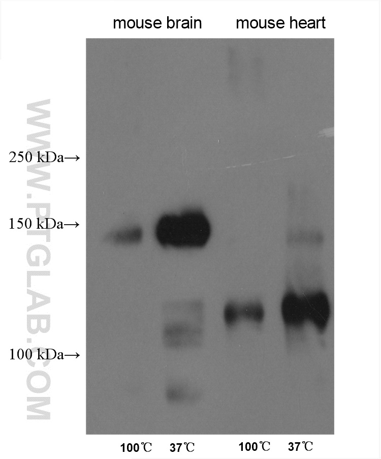 SLC4A3 Polyclonal antibody