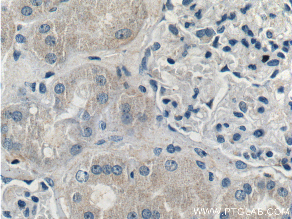 TRIM47 Polyclonal antibody