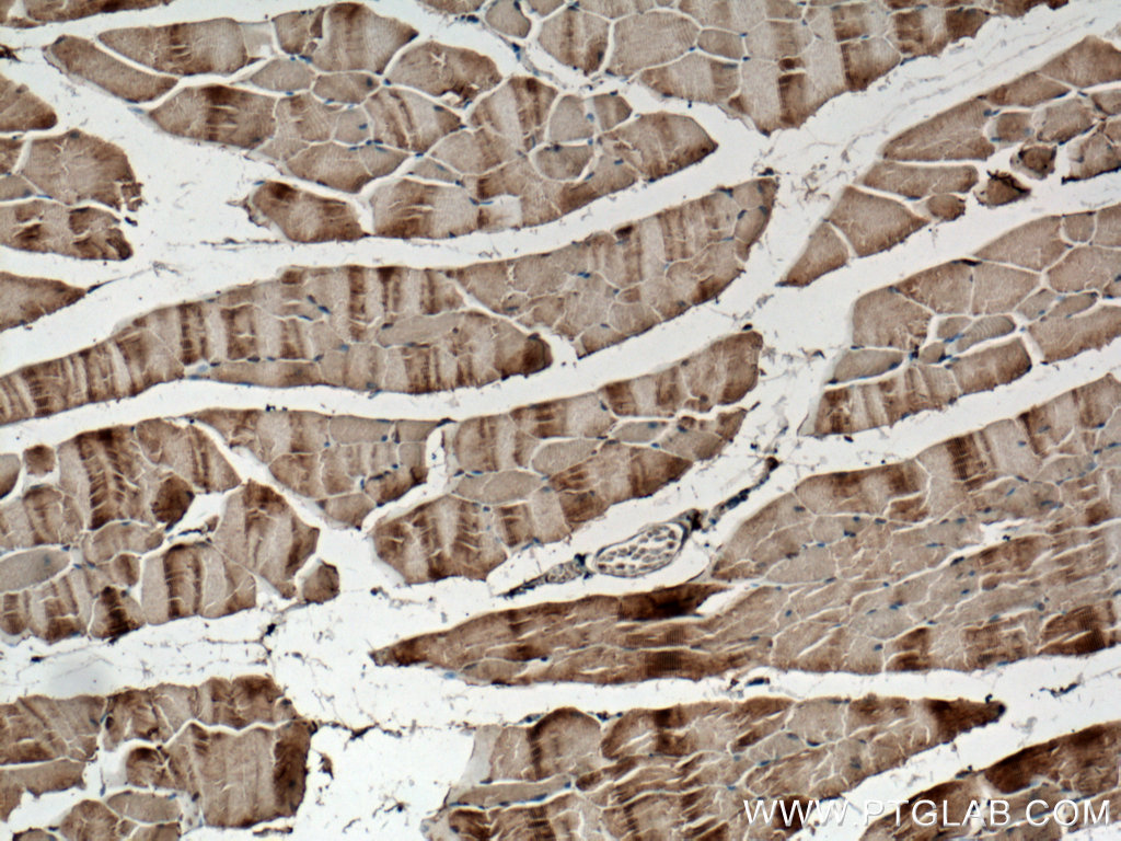 SCAMP3 Polyclonal antibody