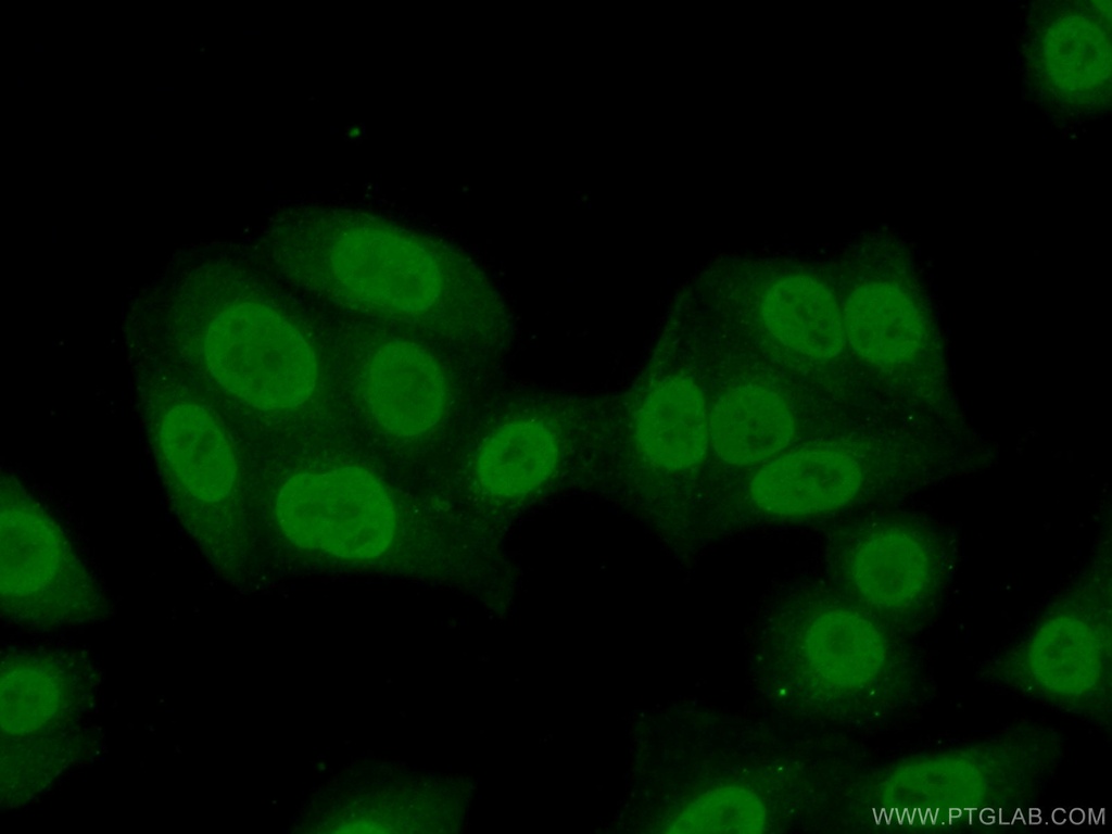 HNRNPM Polyclonal antibody