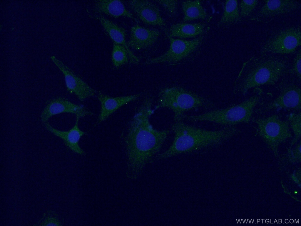 Neuronatin Polyclonal antibody