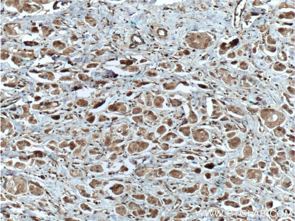 DUSP7/PYST2 Polyclonal antibody