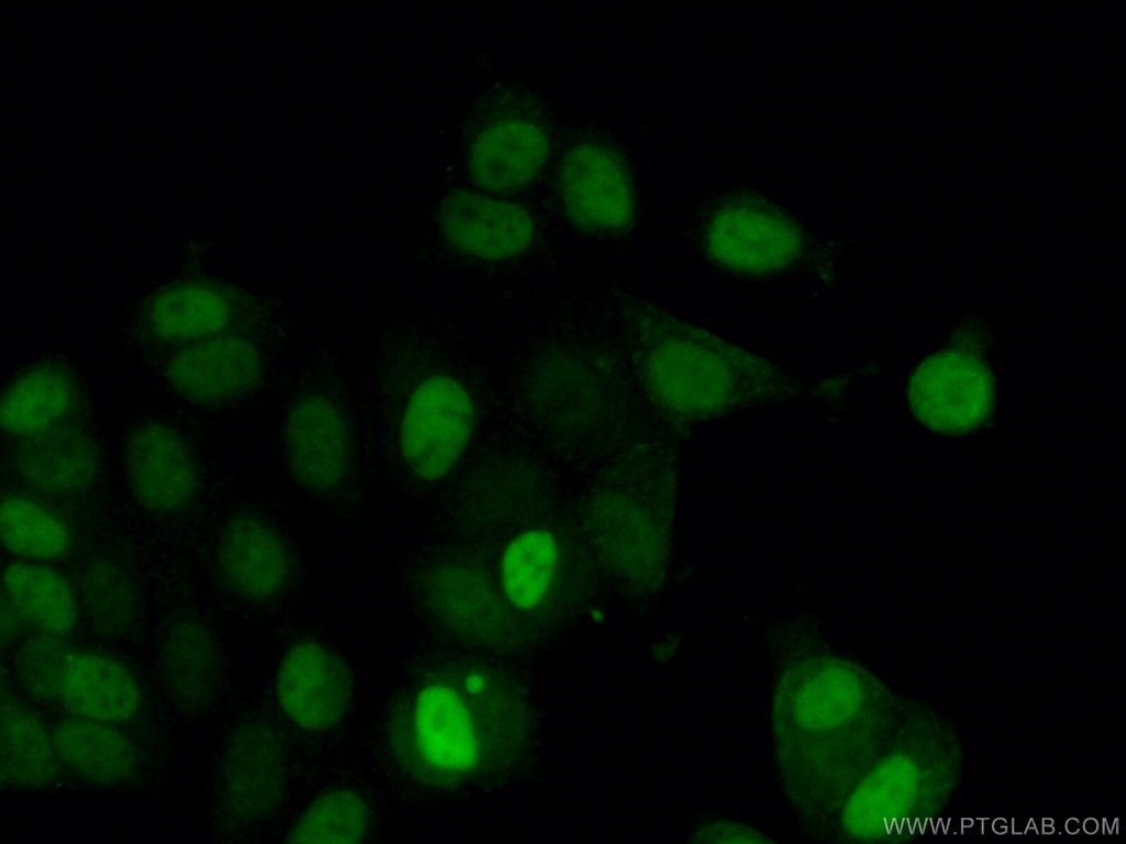 Cyclin D1 Polyclonal antibody