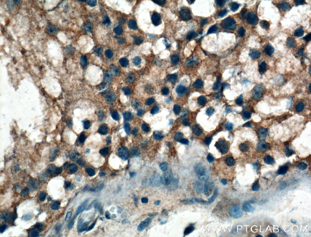 IARS Polyclonal antibody