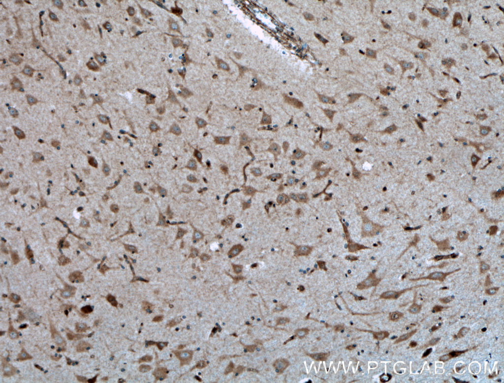 GNRH1 Polyclonal antibody