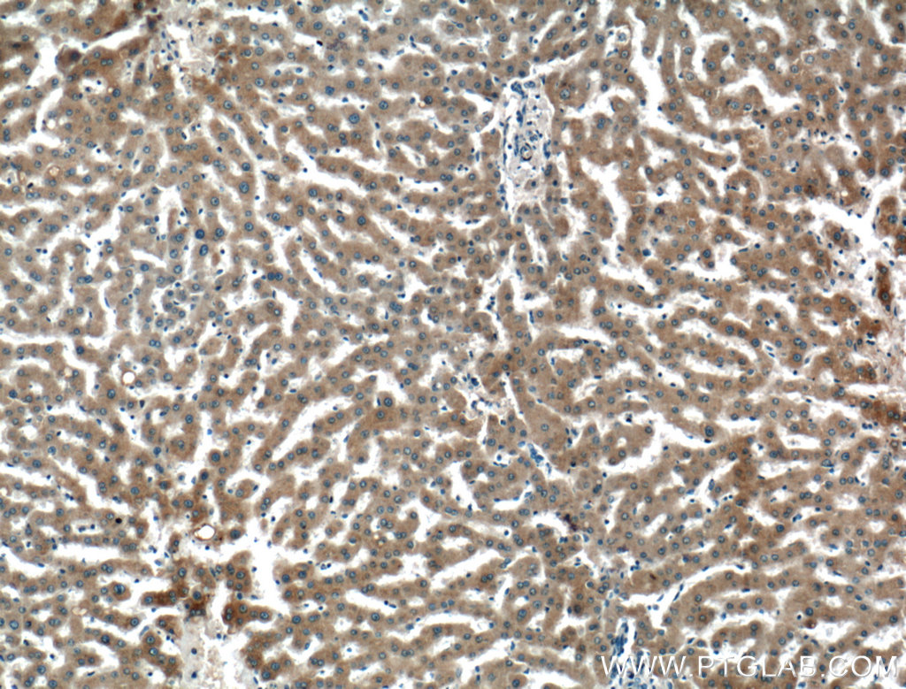Perilipin 5 Polyclonal antibody