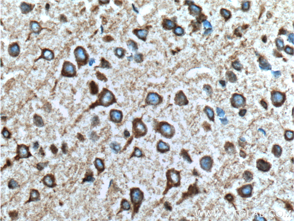RYR1 Polyclonal antibody