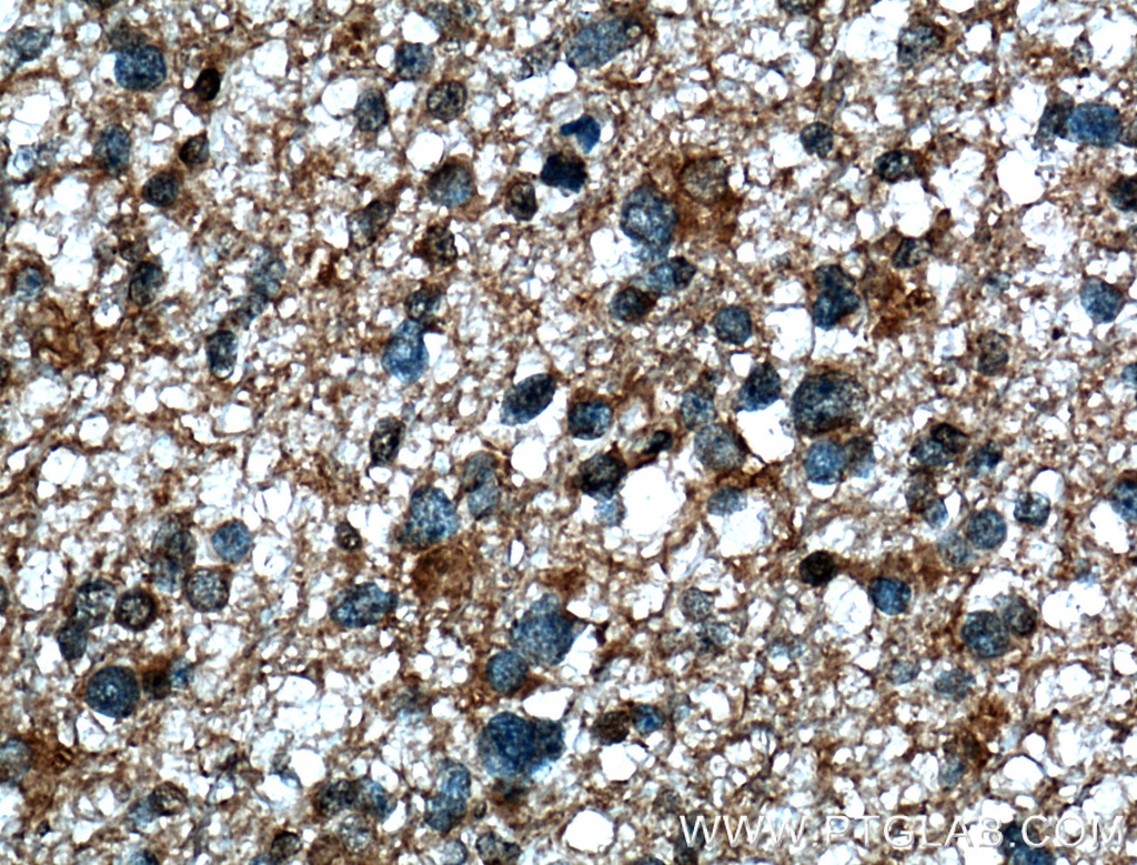 TTYH1 Polyclonal antibody