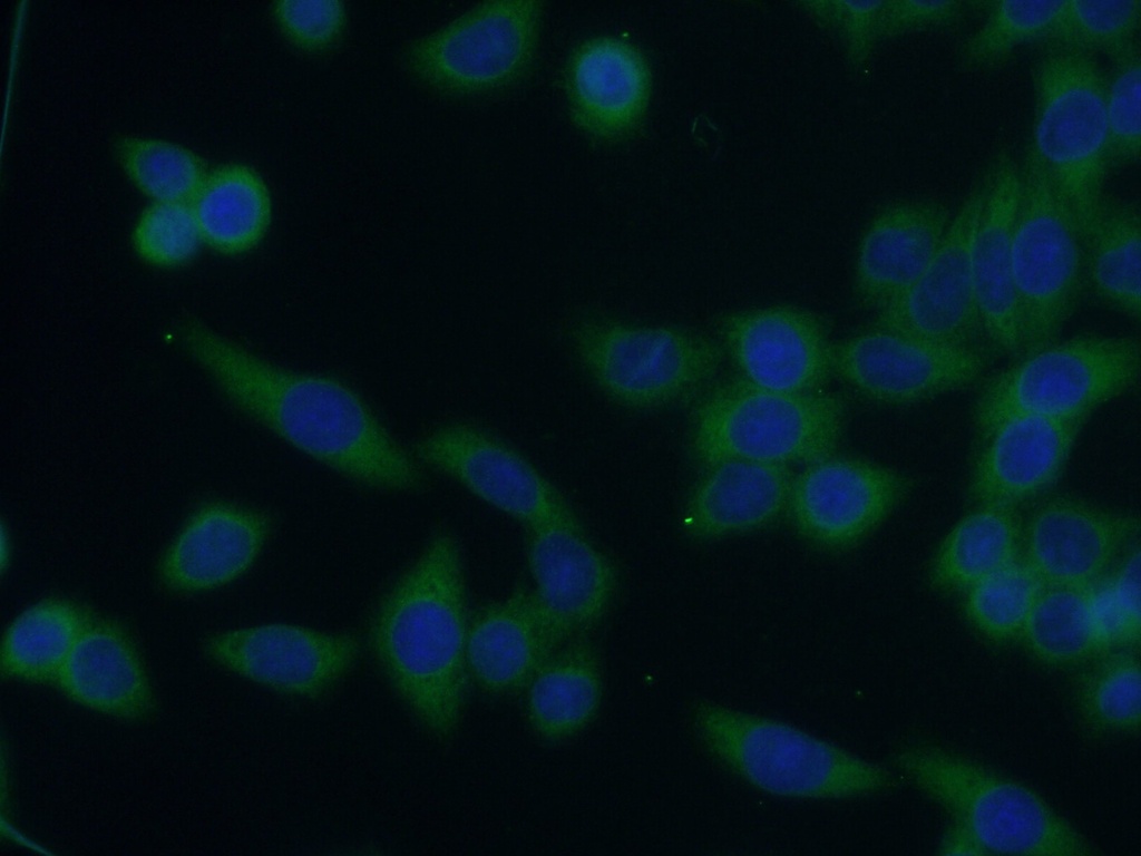 DCDC2 Polyclonal antibody