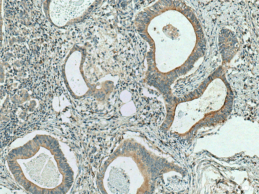 Cystatin S Polyclonal antibody
